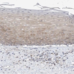THADA Antibody, Novus Biologicals:Antibodies:Primary Antibodies